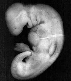 28-day-embryo